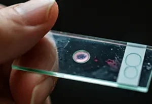 LFT (Liver Function Test)